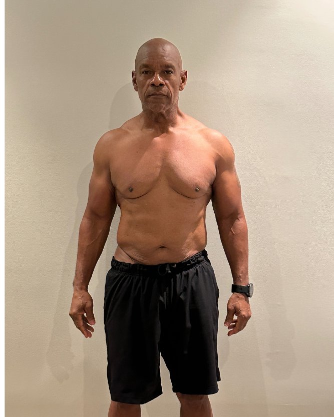 Client before photo